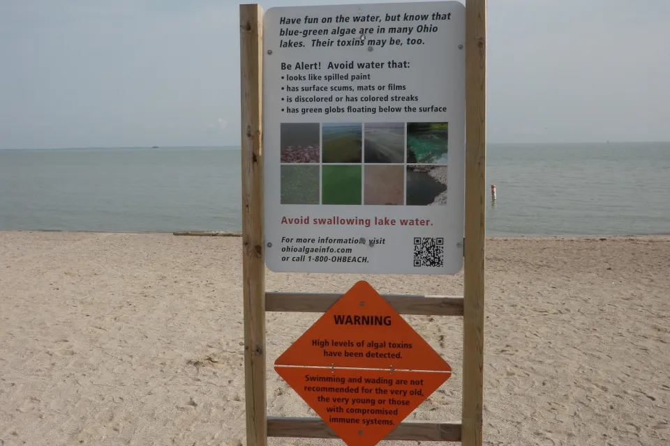 Sign warning of toxic algae bloom at Lake Erie beach in Ohio.